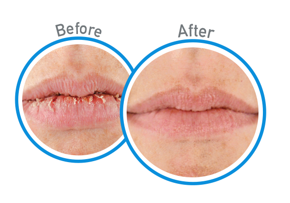 O'Keeffe's Lip Repair Cooling Relief